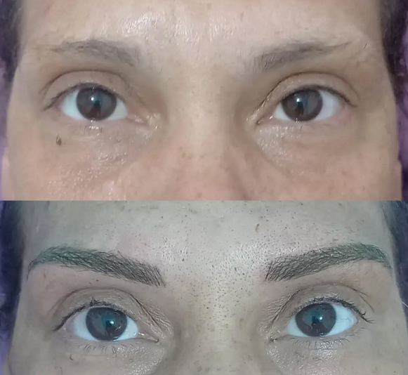 sobrancelhas antes de depois analunesa
