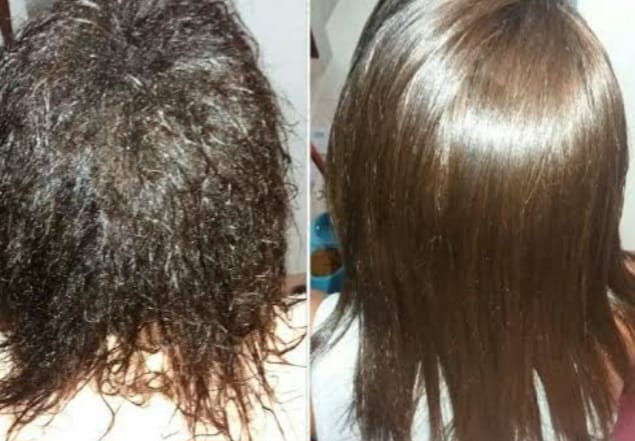 Progressiva analunesa